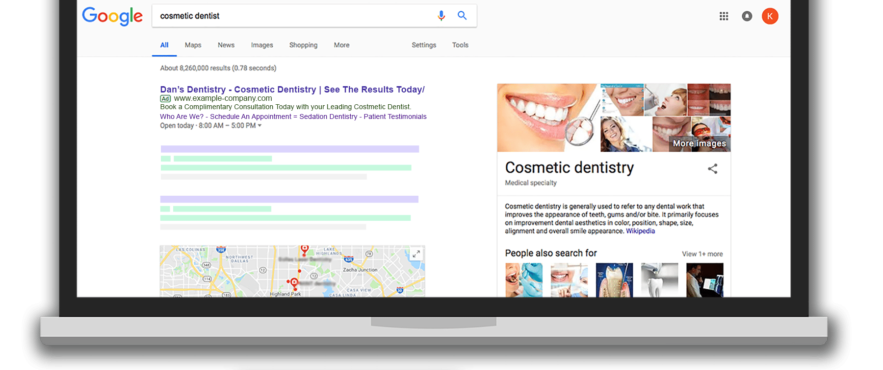 google ads show up first